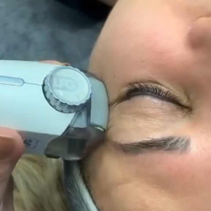 Fransız Öpücüğü